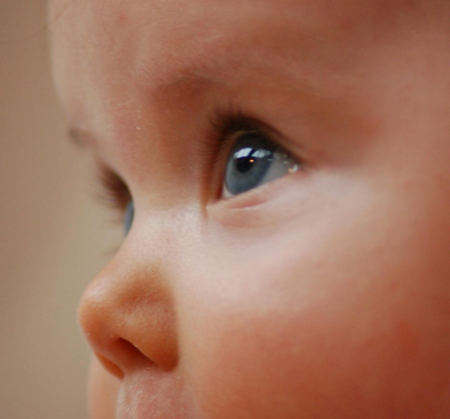 Ojo vago en bebés y niños